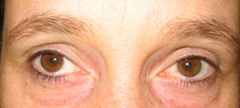 augenbrauen